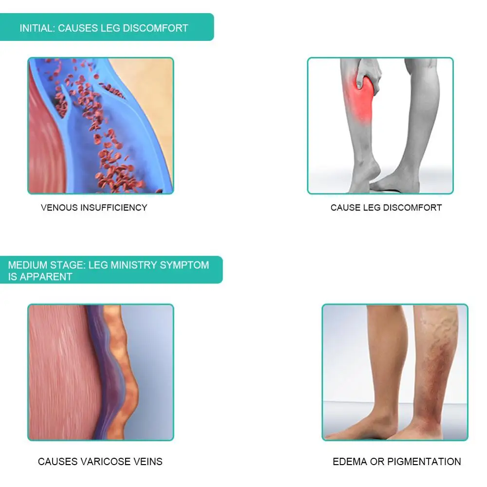 1 пара медицинских компрессион – обзор и цена Compression Sock Medical