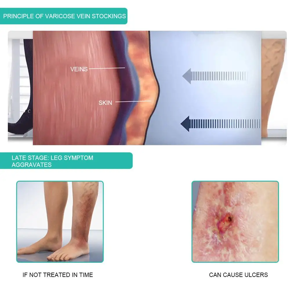 1 пара медицинских компрессион – обзор и цена Compression Sock Medical